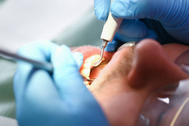 Best Knocked-Out Tooth Emergency  in Tullahoma, TN